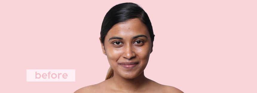 Before applying Face Anything Skin Tint
